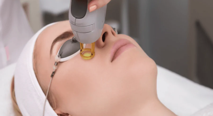 Spectrum Laser/IPL Treatments