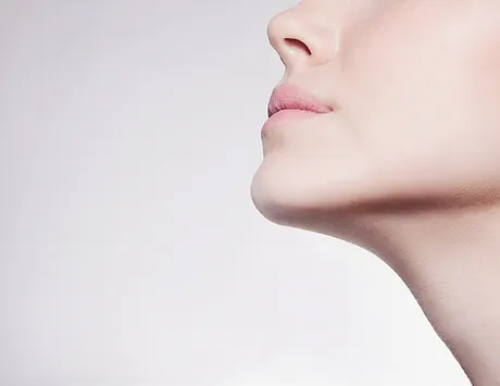 Kybella