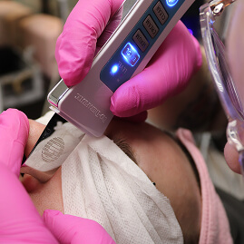 extractions